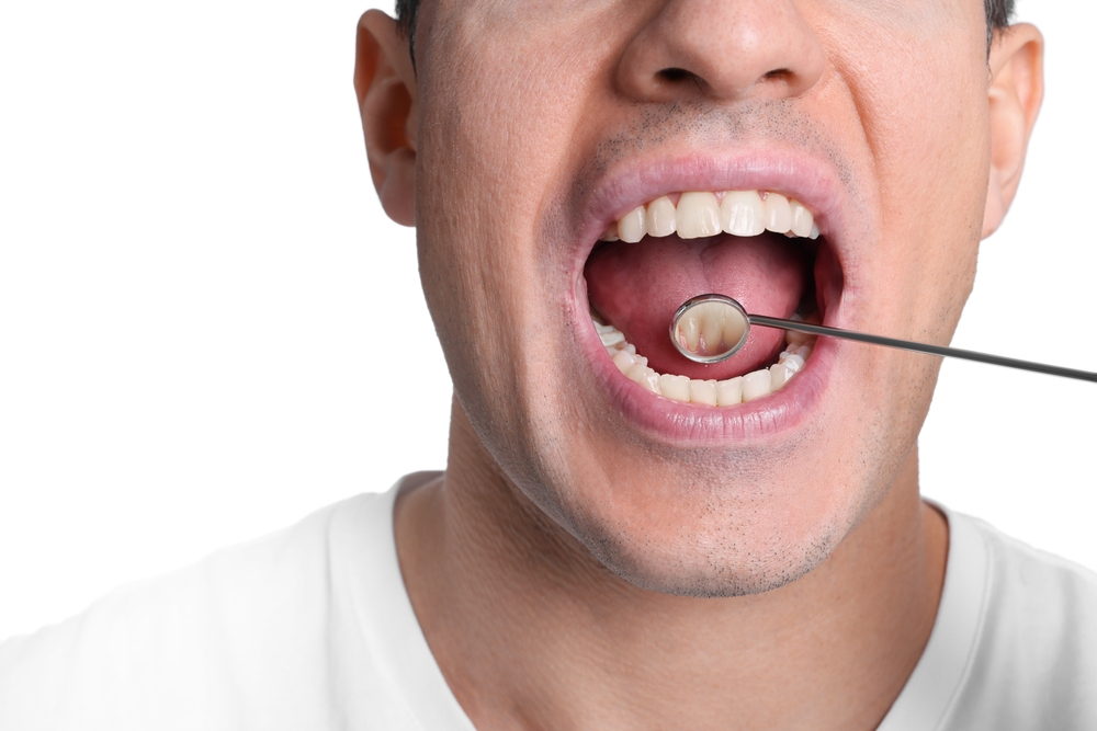 Tumores em Cavidade Oral